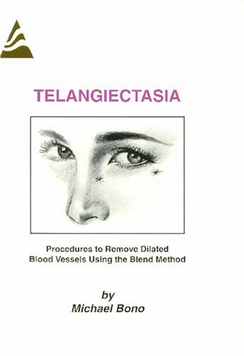 Imagen de archivo de Telangiectasia: Procedures to Remove Dilated Blood Vessels Using the Blend Method a la venta por HPB-Red