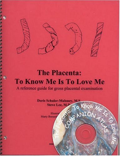 The Placenta: To Know Me Is to Love Me--A Reference Guide for Gross Placental Examination (Book & Companion Atlas CD) (9780967035413) by Schuler-Maloney, Doris; Lee, Steve