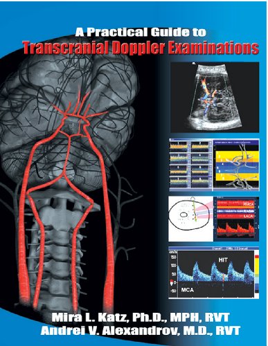 Beispielbild fr Practical Guide to Transcranial Doppler Examinations zum Verkauf von GF Books, Inc.