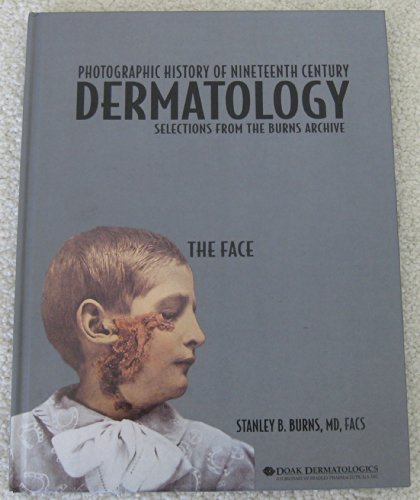 Stock image for Photographic History of Nineteenth Century Dermatology - The Face for sale by HPB-Movies