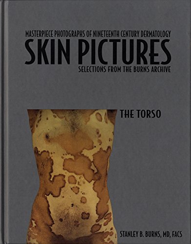 Stock image for PHOTOGRAPHIC HISTORY OF NINETEENTH CENTURY DERMATOLOGY - Selections from the Burns archive - The Torso for sale by HPB-Movies