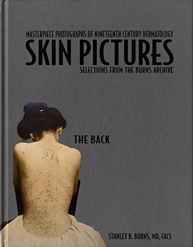 Stock image for Photographic History of Nineteenth Century Dermatology: The Back for sale by HPB-Red