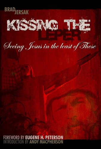 9780978017408: Kissing the Leper: Seeing Jesus in the Least of These