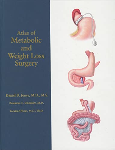 Imagen de archivo de Atlas of Metabolic and Weight Loss Surgery a la venta por Ergodebooks