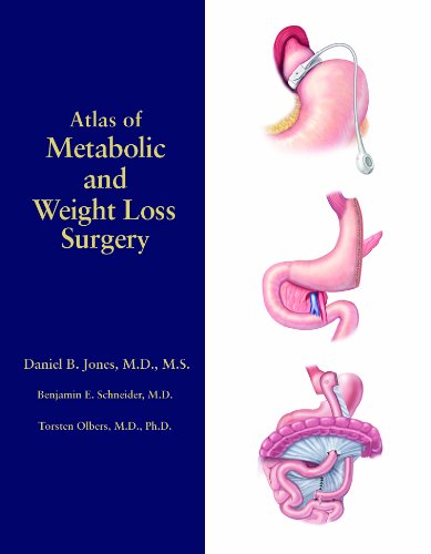 Stock image for Atlas of Metabolic and Weight Loss Surgery for sale by HPB-Red
