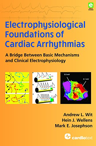 Beispielbild fr Electrophysiological Foundations of Cardiac Arrhythmias: A Bridge Between Basic Mechanisms and Clinical Electrophysiology zum Verkauf von GoldenWavesOfBooks