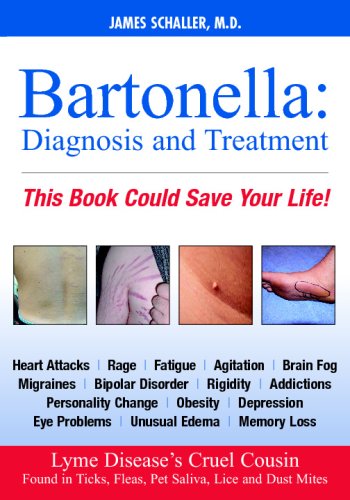 Imagen de archivo de Bartonella: Diagnosis and Treatment (Dhivehi Edition) a la venta por ThriftBooks-Dallas