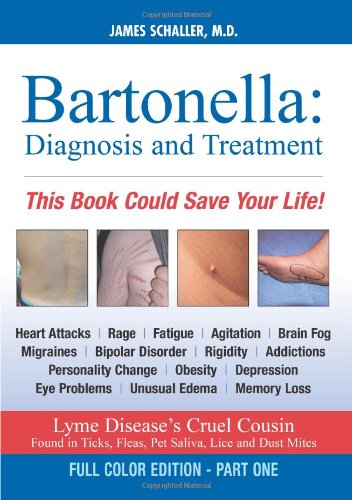 Imagen de archivo de Bartonella: Diagnosis and Treatment: Part 1 of 2, Full Color Edition a la venta por -OnTimeBooks-