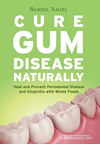 Stock image for Cure Gum Disease Naturally: Heal and Prevent Periodontal Disease and Gingivitis with Whole Foods for sale by GF Books, Inc.