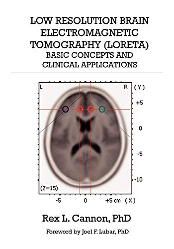 Imagen de archivo de Low Resolution Brain Electromagnetic Tomography (LORETA): Basic Concepts and Clinical Applications a la venta por Seattle Goodwill