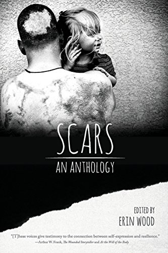 Stock image for Scars: An Anthology for sale by SecondSale