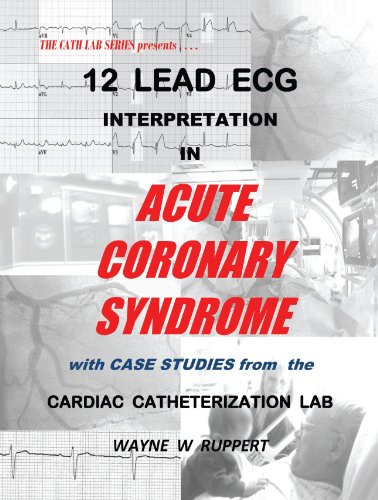 Beispielbild fr 12 Lead ECG Interpretation in Acute Coronary Syndrome with Case Studies from the Cardiac Catheterization Lab zum Verkauf von PBShop.store US