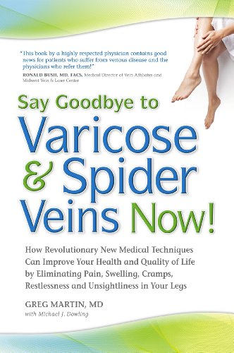 Beispielbild fr Say Goodbye to Varicose Spider Veins Now! zum Verkauf von Goodwill Books