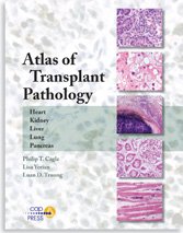 Stock image for ATLAS OF TRANSPLANT PATHOLOGY for sale by Front Cover Books