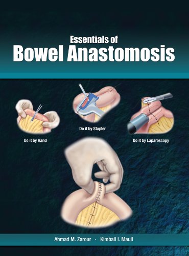 Stock image for Essentials of Bowel Anastomosis for sale by Save With Sam