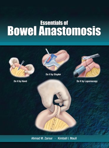 9780984617197: Essentials of Bowel Anastomosis