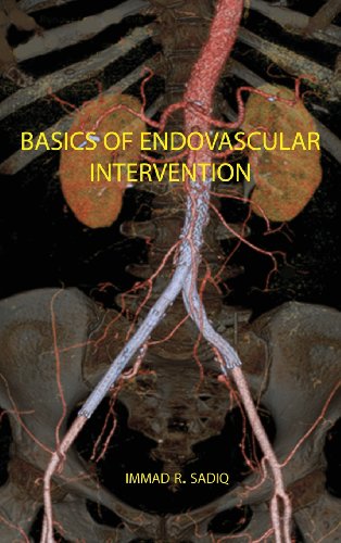 9780985850005: Basics of Endovascular Intervention