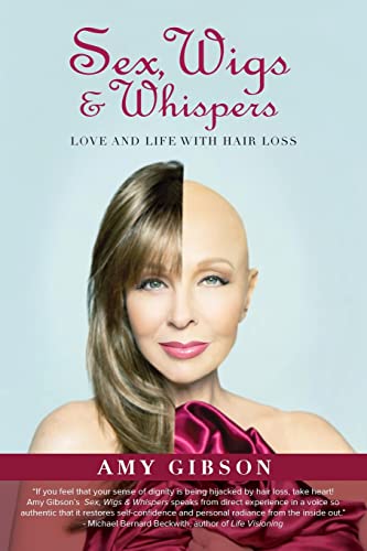 Stock image for Sex, Wigs & Whispers: Love and Life with Hair Loss for sale by SecondSale