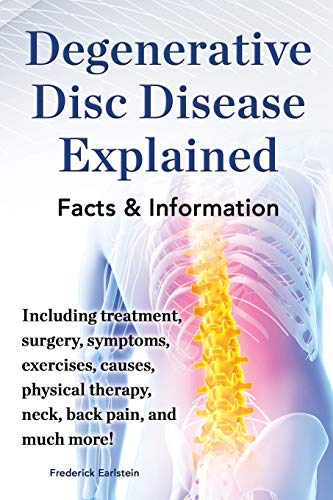 Stock image for Degenerative Disc Disease Explained. Including Treatment, Surgery, Symptoms, Exercises, Causes, Physical Therapy, Neck, Back, Pain, and Much More! Fac (Paperback or Softback) for sale by BargainBookStores