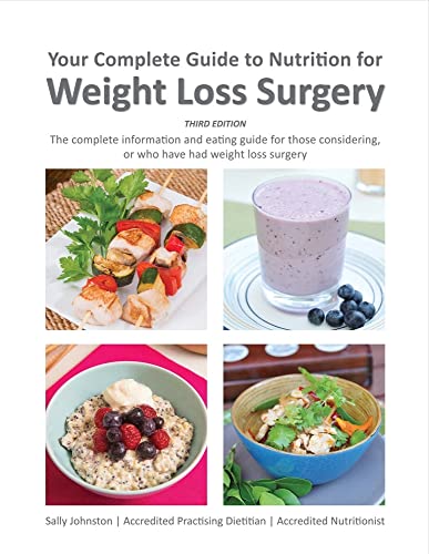 9780992434632: Your Complete Guide to Nutrition for Weight Loss Surgery