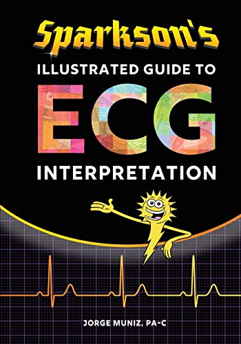 Imagen de archivo de Sparkson's Illustrated Guide to ECG Interpretation a la venta por Better World Books