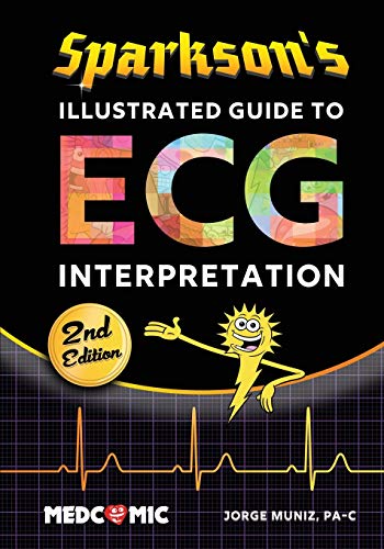 Imagen de archivo de Sparkson's Illustrated Guide to ECG Interpretation, 2nd Edition a la venta por HPB-Red