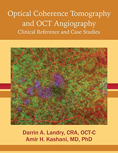 Stock image for Optical Coherence Tomography and OCT Angiography: Clinical Reference and Case Studies for sale by GF Books, Inc.