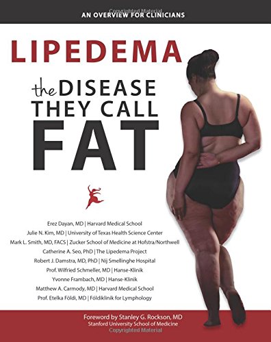 9780998984513: Lipedema - The Disease They Call FAT: An Overview for Clinicians