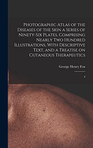 Stock image for Photographic Atlas of the Diseases of the Skin a Series of Ninety-six Plates, Comprising Nearly two Hundred Illustrations, With Descriptive Text, and for sale by GreatBookPrices