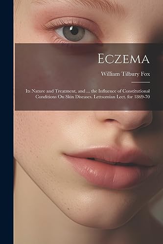 Stock image for Eczema: Its Nature and Treatment, and . the Influence of Constitutional Conditions On Skin Diseases. Lettsomian Lect. for 1869-70 for sale by THE SAINT BOOKSTORE