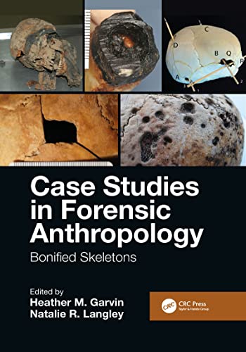 Beispielbild fr Case Studies in Forensic Anthropology zum Verkauf von Blackwell's