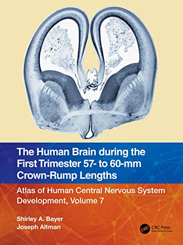 Stock image for The Human Brain During the First Trimester 57- To 60-Mm Crown-Rump Lengths for sale by Blackwell's