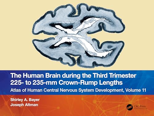 Stock image for The Human Brain During the Third Trimester 225- To 235-Mm Crown-Rump Lengths for sale by Blackwell's