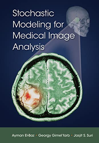 Stock image for Stochastic Modeling for Medical Image Analysis for sale by Blackwell's