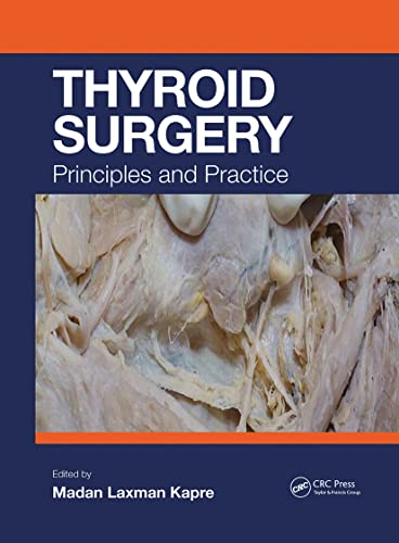 Beispielbild fr Thyroid Surgery zum Verkauf von Blackwell's