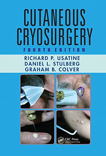 Stock image for Cutaneous Cryosurgery for sale by Blackwell's