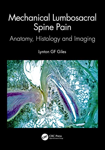 Stock image for MECHANICAL LUMBOSACRAL SPINE PAIN ANATOMY HISTOLOGY AND IMAGING (PB 2023) for sale by Basi6 International