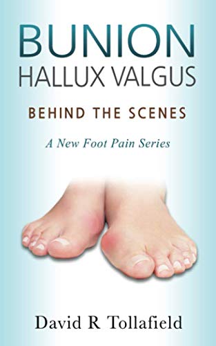 Beispielbild fr Bunion (Hallux valgus): Behind the Scenes: Foot Pain Series (Reflective Podiatric Practice) zum Verkauf von WorldofBooks