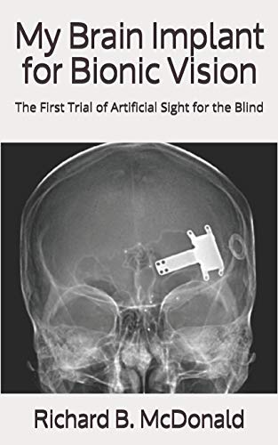 9781081018801: My Brain Implant for Bionic Vision: The First Trial of Artificial Sight for the Blind