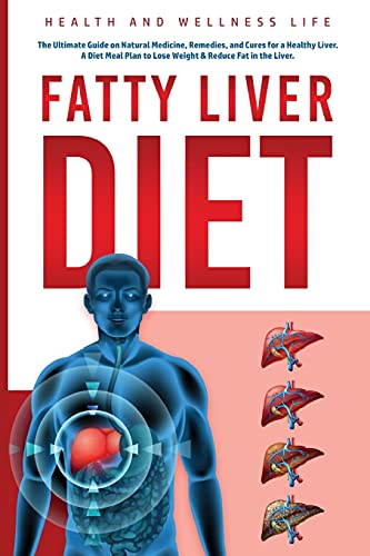 Imagen de archivo de Fatty Liver Diet: The Ultimate Guide on Natural Medicine, Remedies, and Cures for a Healthy Liver. A Diet Meal Plan to Lose Weight & Reduce Fat in a la venta por GreatBookPrices