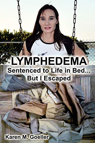 Stock image for Lymphedema. Sentenced to Life in Bed, But I Escaped for sale by ThriftBooks-Dallas