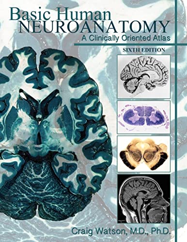 Basic Human Neuroanatomy: A Clinically Oriented Atlas (9781105193637) by Watson, Craig