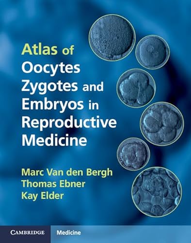 Stock image for Atlas of Oocytes, Zygotes and Embryos in Reproductive Medicine Hardback with CD-ROM for sale by Re-Read Ltd