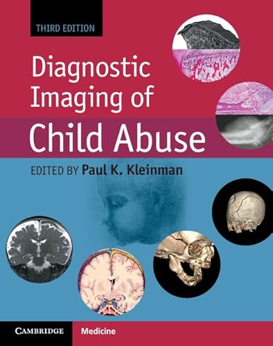 Imagen de archivo de Diagnostic Imaging of Child Abuse a la venta por AMM Books