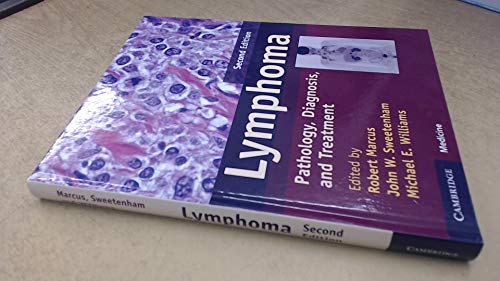 Stock image for Myeloma: Pathology, Diagnosis, and Treatment for sale by AMM Books