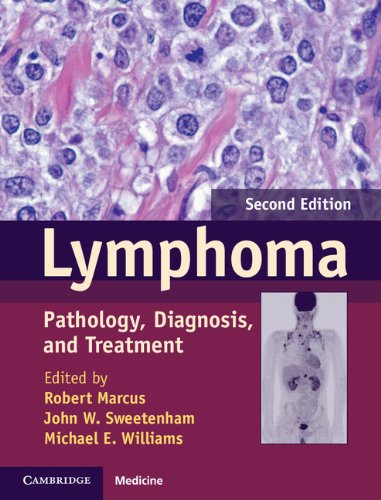 9781107010598: Lymphoma: Pathology, Diagnosis, and Treatment