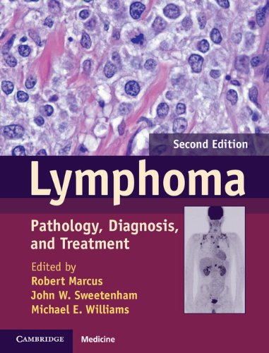 Lymphoma: Pathology, Diagnosis, and Treatment (Cambridge Medicine)