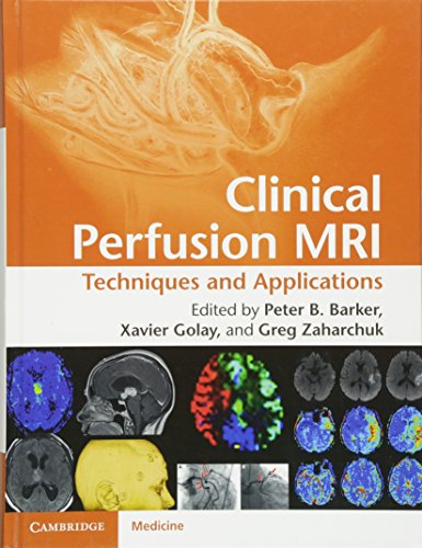 9781107013391: Clinical Perfusion MRI: Techniques and Applications