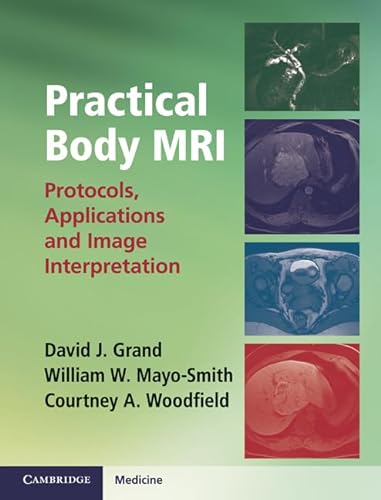 Beispielbild fr Practical Body MRI zum Verkauf von Blackwell's