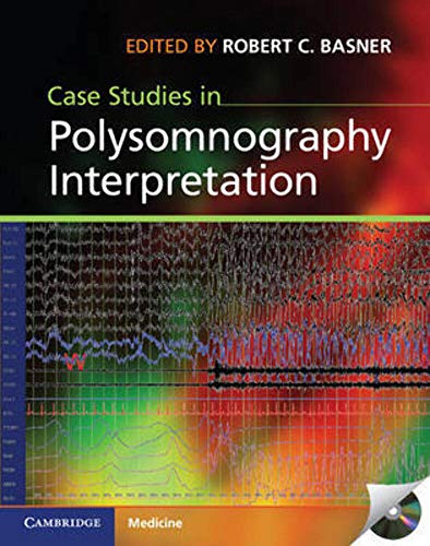 9781107015395: Case Studies in Polysomnography Interpretation (Cambridge Medicine (Hardcover))